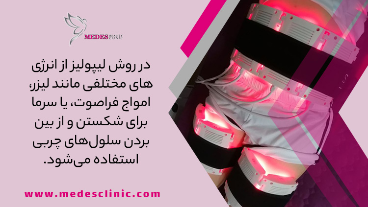 لاغری با دستگاه لیپولیز