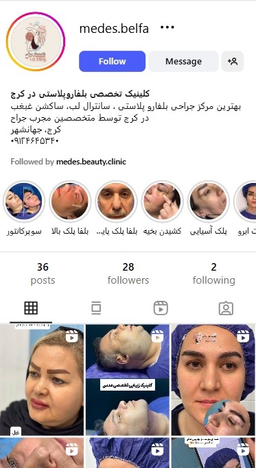 مرکز جراحی بلفاروپلاستی مدس کرج