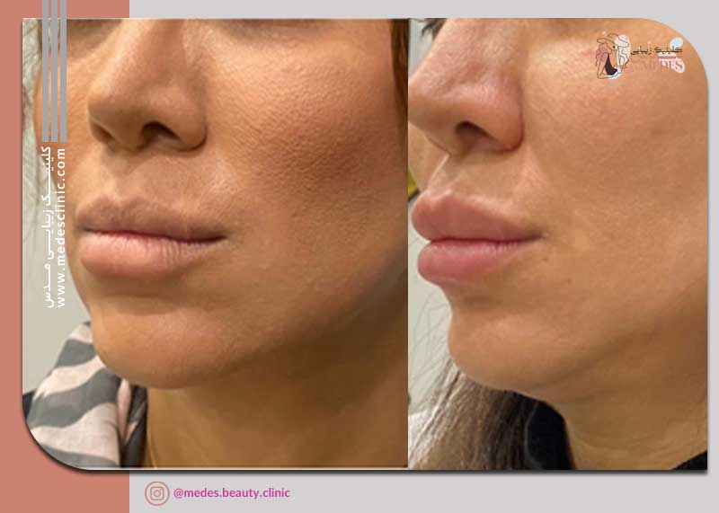 گالری اندولیفت