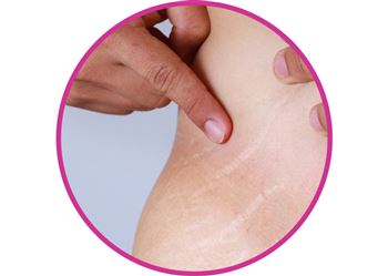 گالری کربوکسی تراپی