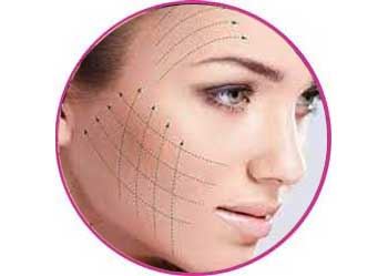 گالری اندولیفت