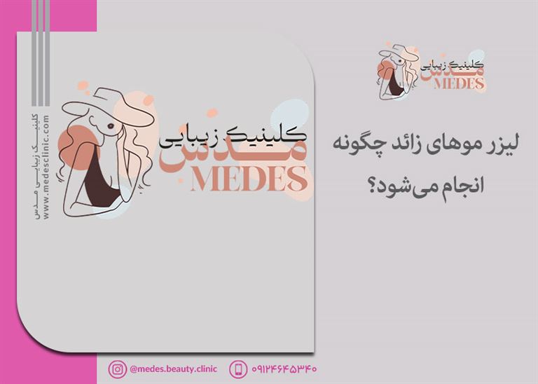 لیزر موهای زائد