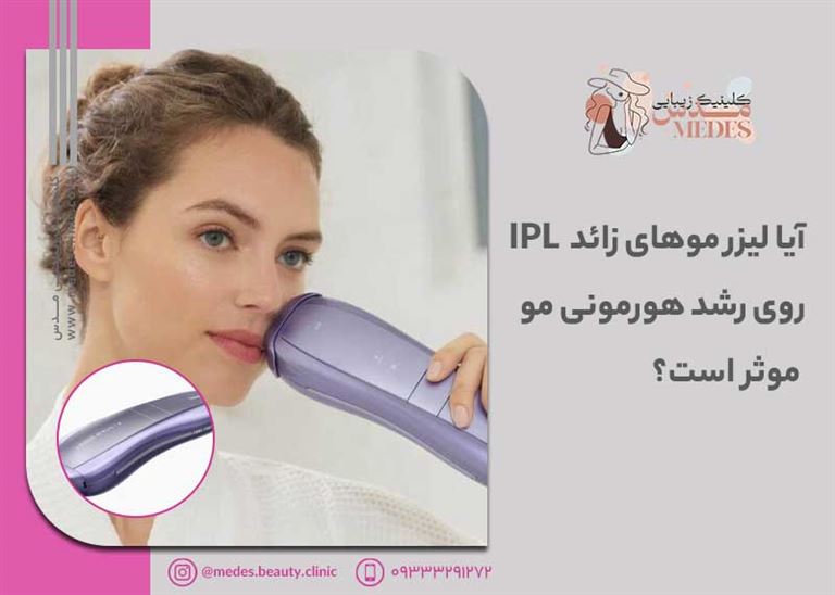 آیا لیزر موهای زائد روی رشد هورمونی مو موثر است؟