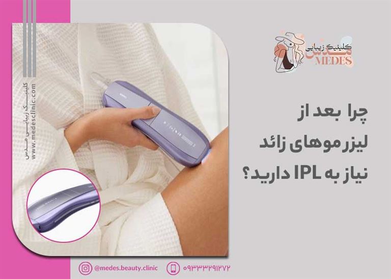 چرا بعد از لیزر موهای زائد نیاز به استفاده از دستگاه IPL دارید؟