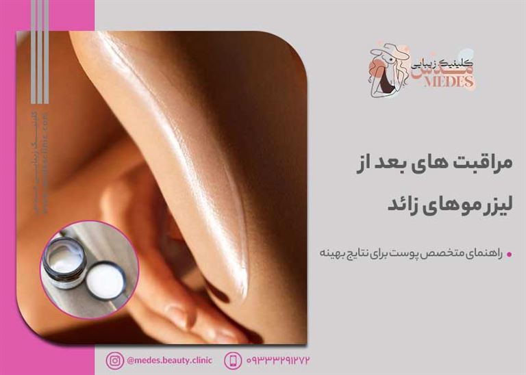 مراقبت های بعد از لیزر موهای زائد