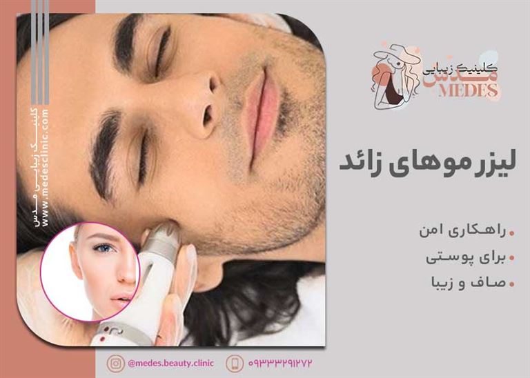 لیزر موهای زائد