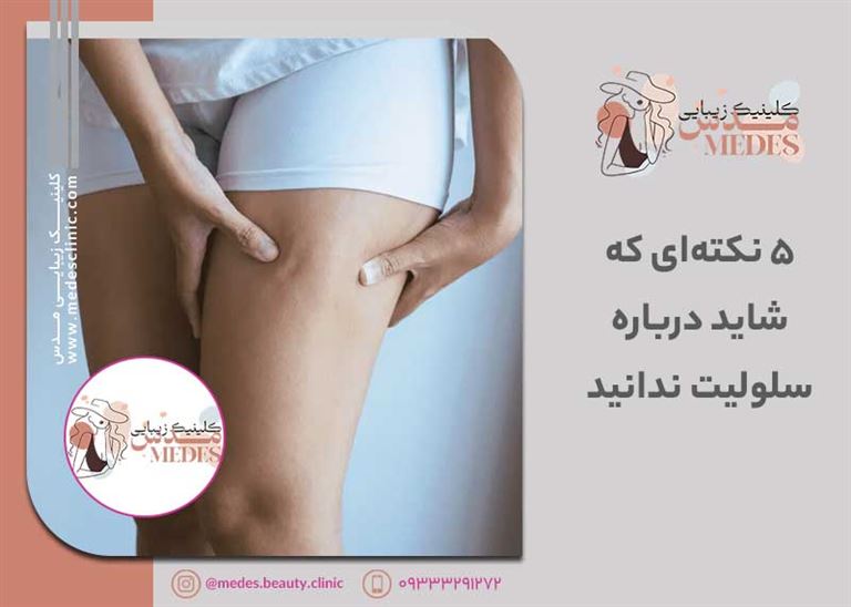 ۵ نکته‌ای که شاید درباره سلولیت ندانید