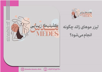 لیزر موهای زائد