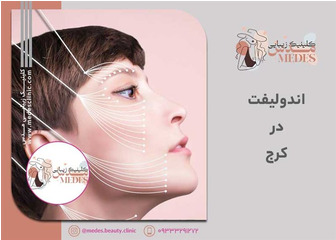 اندولیفت صورت