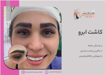 کاشت ابرو