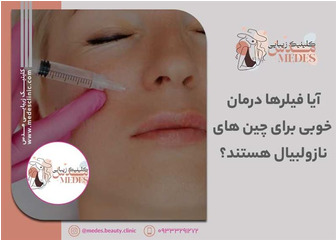 آیا فیلرهای پوستی برای چین‌های نازولبیال مؤثر هستند؟