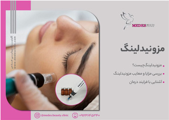 مزونیدلینگ صورت