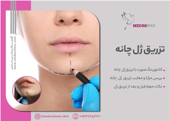 زاویه سازی صورت