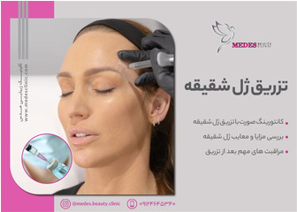 تزریق ژل به شقیقه