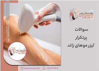 سوالات متداول در مورد لیزر موهای زائد
