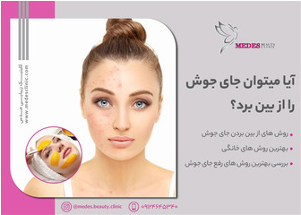 آیا می‌توان جای جوش را از بین برد؟