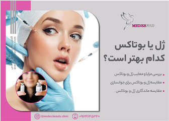تزریق ژل بهتر است یا بوتاکس؟