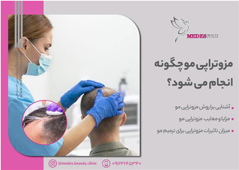 مزوتراپی مو چگونه انجام می‌شود؟