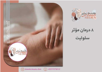 ۸ درمان مؤثر سلولیت در ۲۰۲۵