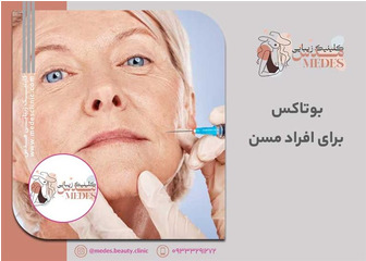 بوتاکس برای افراد مسن: راز جوانی پوست در سنین بالا