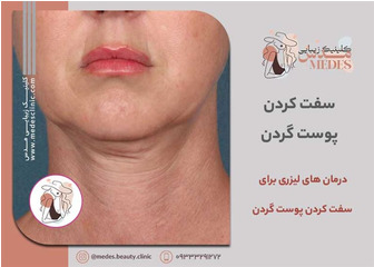 درمان های لیزری برای سفت کردن پوست گردن