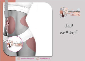 تزریق آمپول لاغری