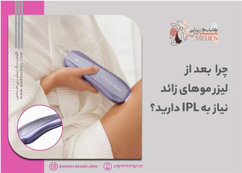 چرا بعد از لیزر موهای زائد نیاز به استفاده از دستگاه IPL دارید؟