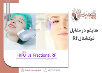 هایفو در مقابل  فرکشنال Rf