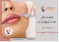 مراقبت‌ های بعد از تزریق ژل لب