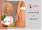رفع ترک پوستی و استرچ مارک در کرج