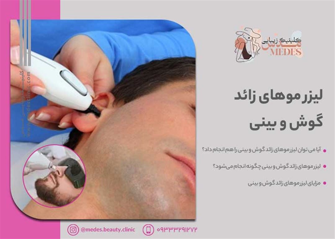لیزر موهای زائد گوش و بینی