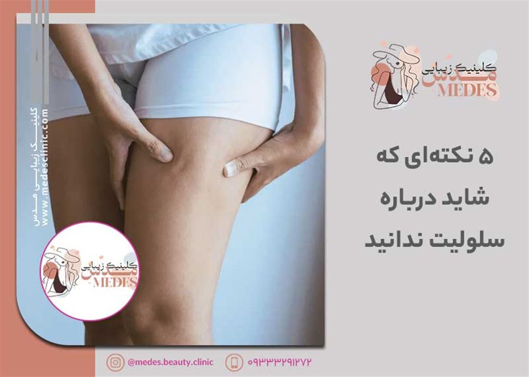 ۵ نکتهای که شاید درباره سلولیت ندانید