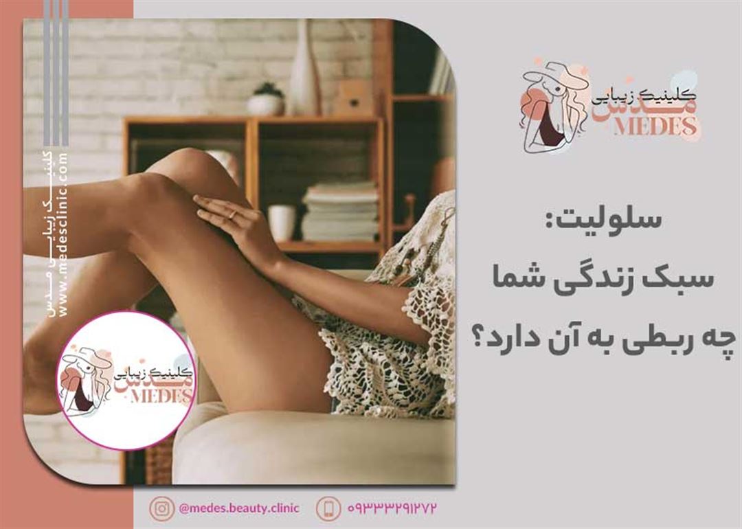 سلولیت: سبک زندگی شما چه ربطی به آن دارد؟