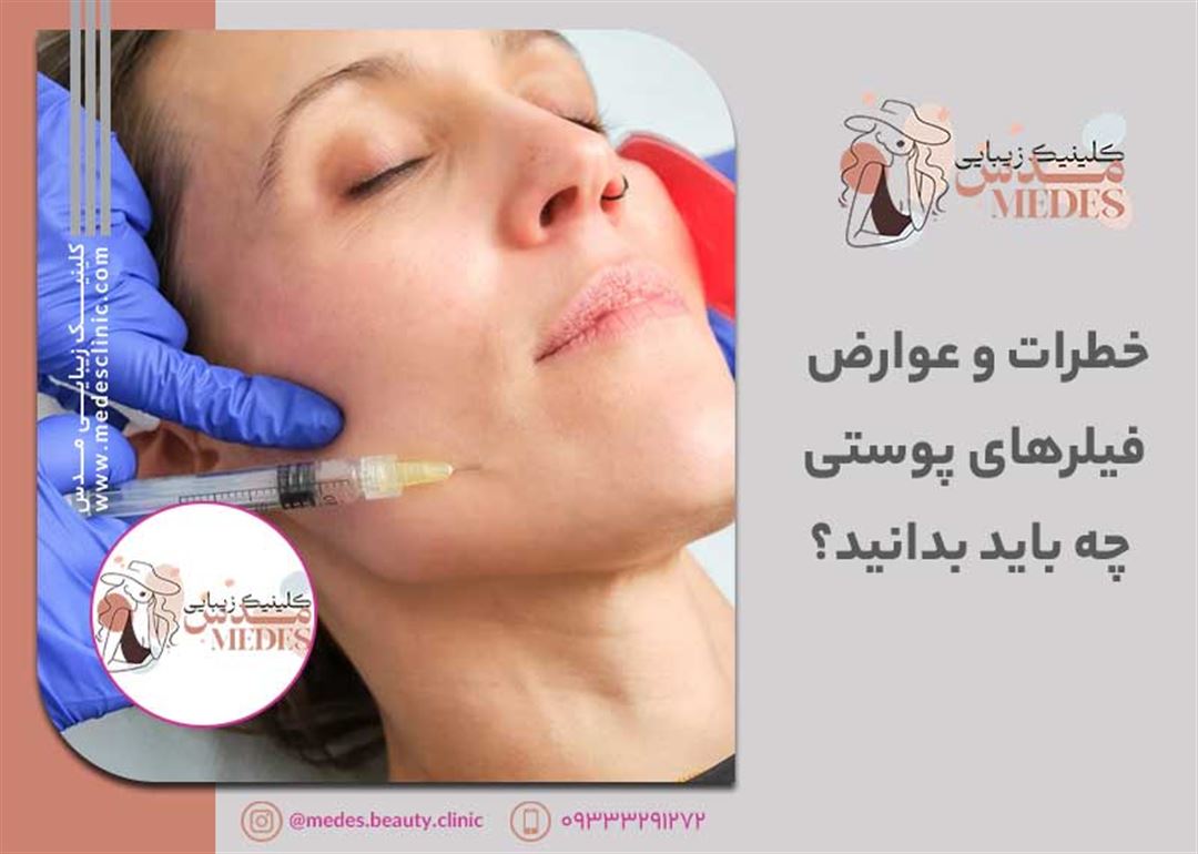 خطرات و عوارض ژل ها: چه باید بدانید؟