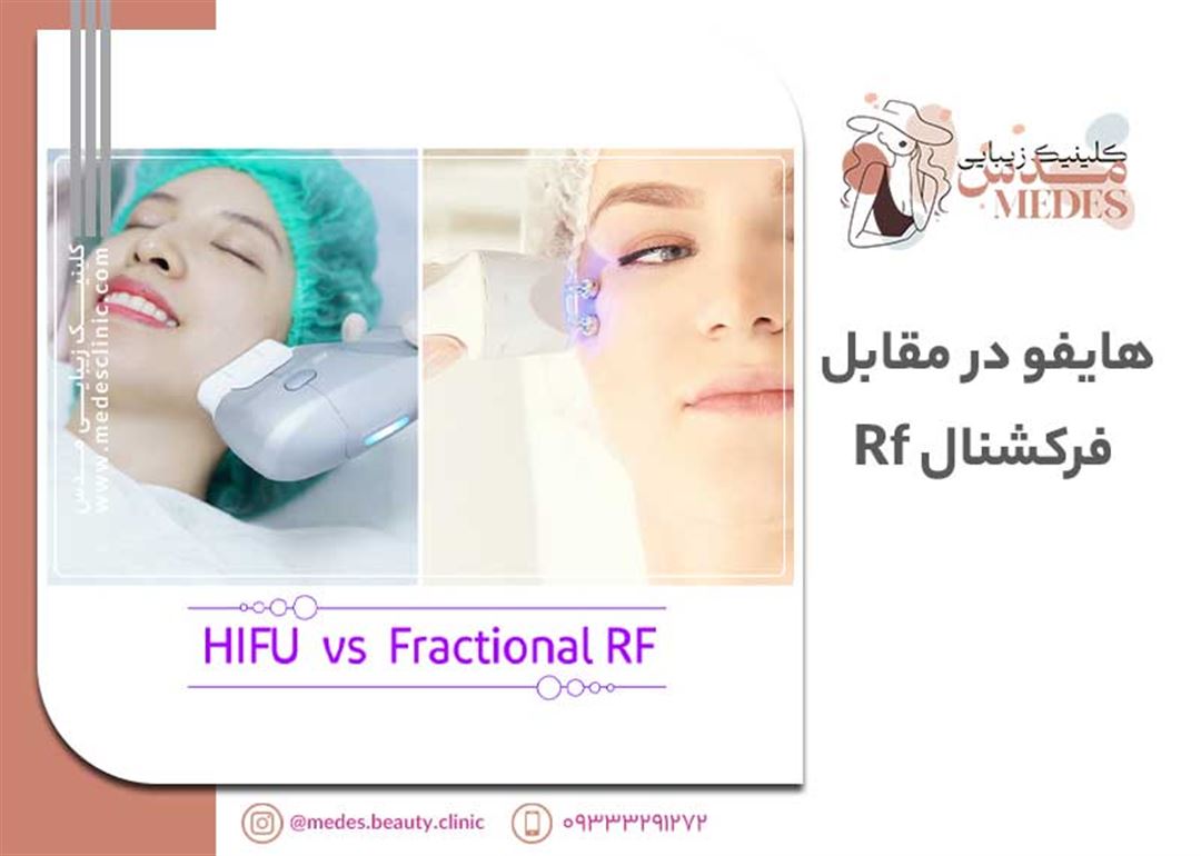 هایفو در مقابل فرکشنال Rf، بهترین درمان برای شما چیست؟