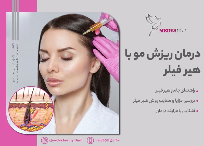 تزریق هیر فیلر در کرج | قیمت، مزایا و تصاویر قبلوبعد