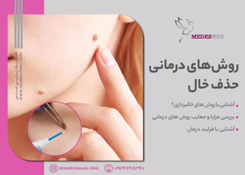 خالبرداری