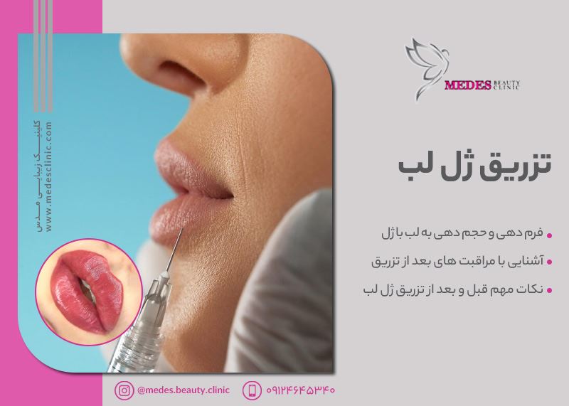 بهترین مرکز تزریق ژل لب