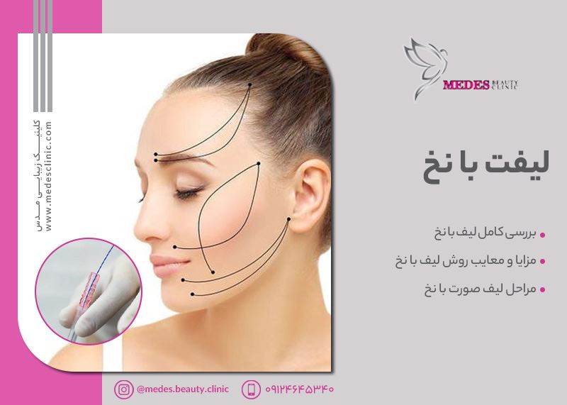 لیفت نخ