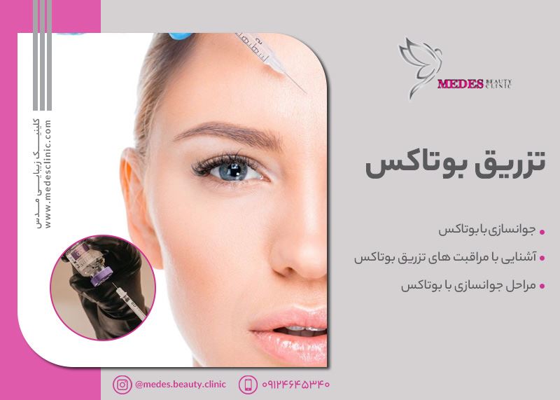 بوتاکس در کرج | بهترین دکتر بوتاکس در کرج