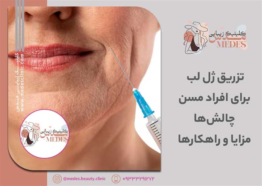 تزریق ژل لب برای افراد مسن: چالشها، مزایا و راهکارها