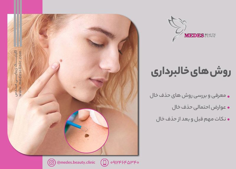 روش های خال برداری