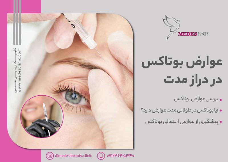 عوارض بوتاکس در دراز مدت