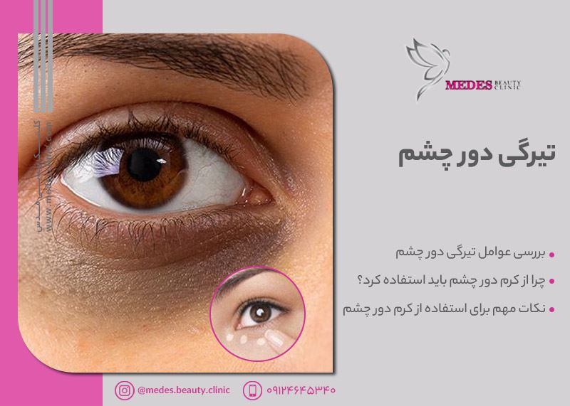 کرم دور چشم برای حلقه های تیره | معرفی 4 مزیت اصلی