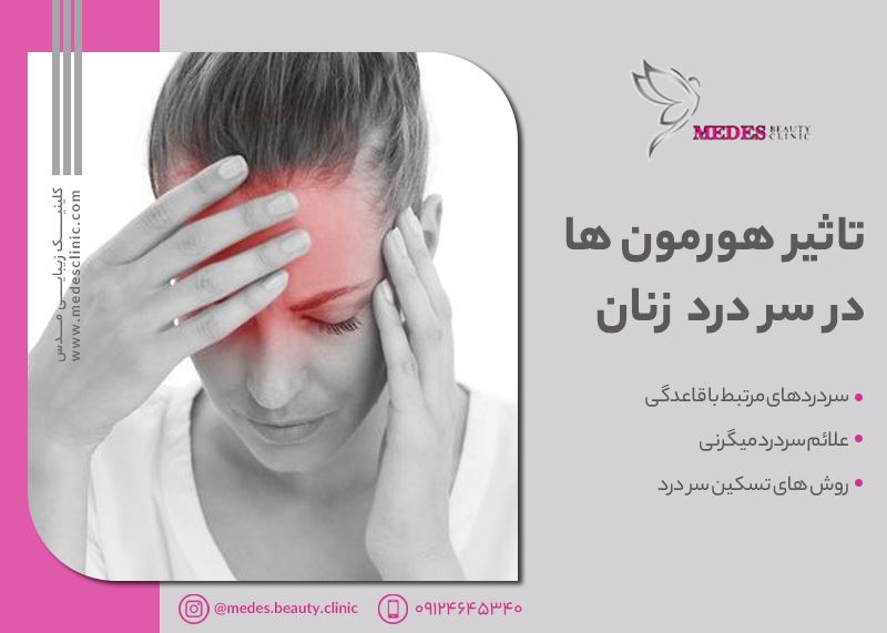 سردرد و زنان: هورمون ها چه ارتباطی با آن دارند؟