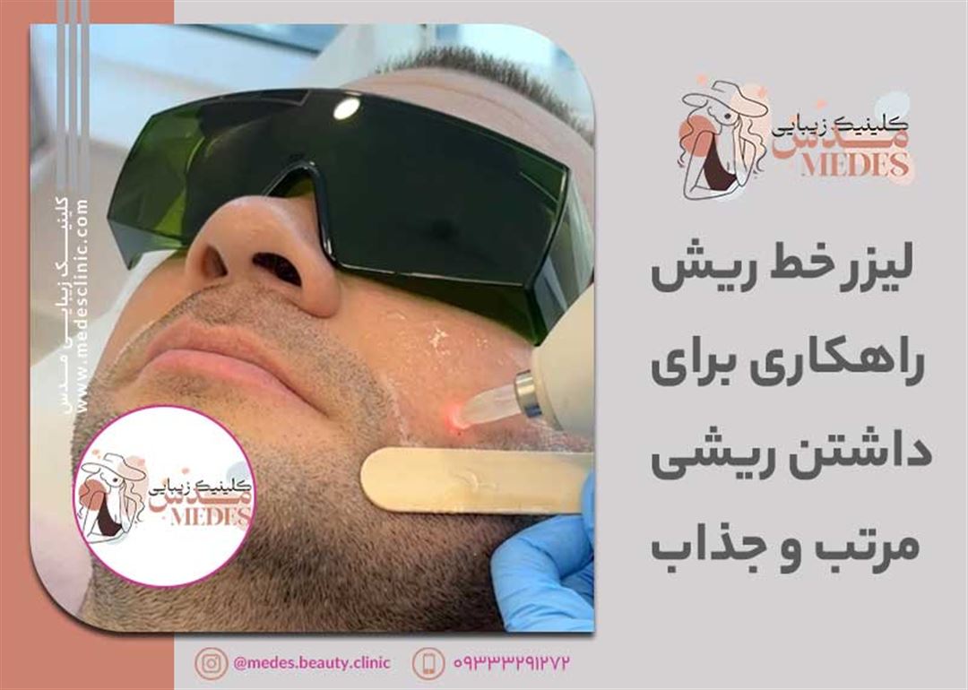 لیزر خط ریش در کرج: راهکاری برای داشتن ریشی مرتب و جذاب