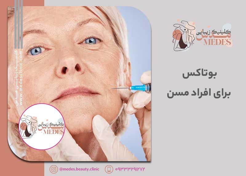 بوتاکس برای افراد مسن: راز جوانی پوست در سنین بالا