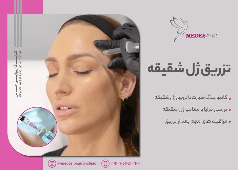 تزریق ژل به گونه و شقیقه